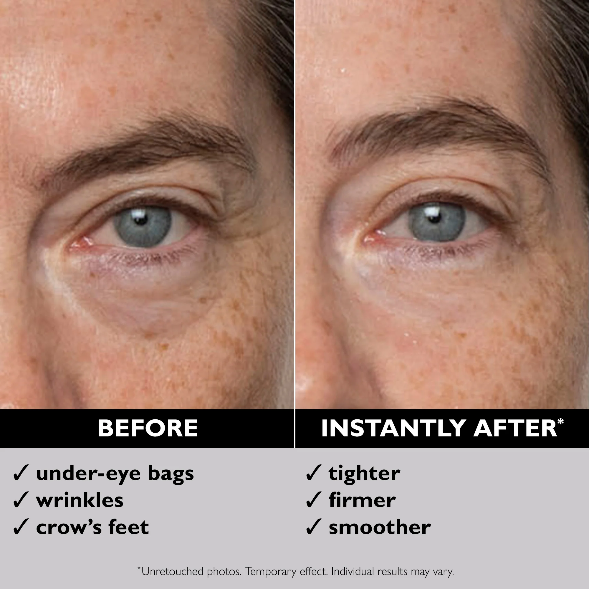 Ava&Rose™ - Temporary Eye Tightener