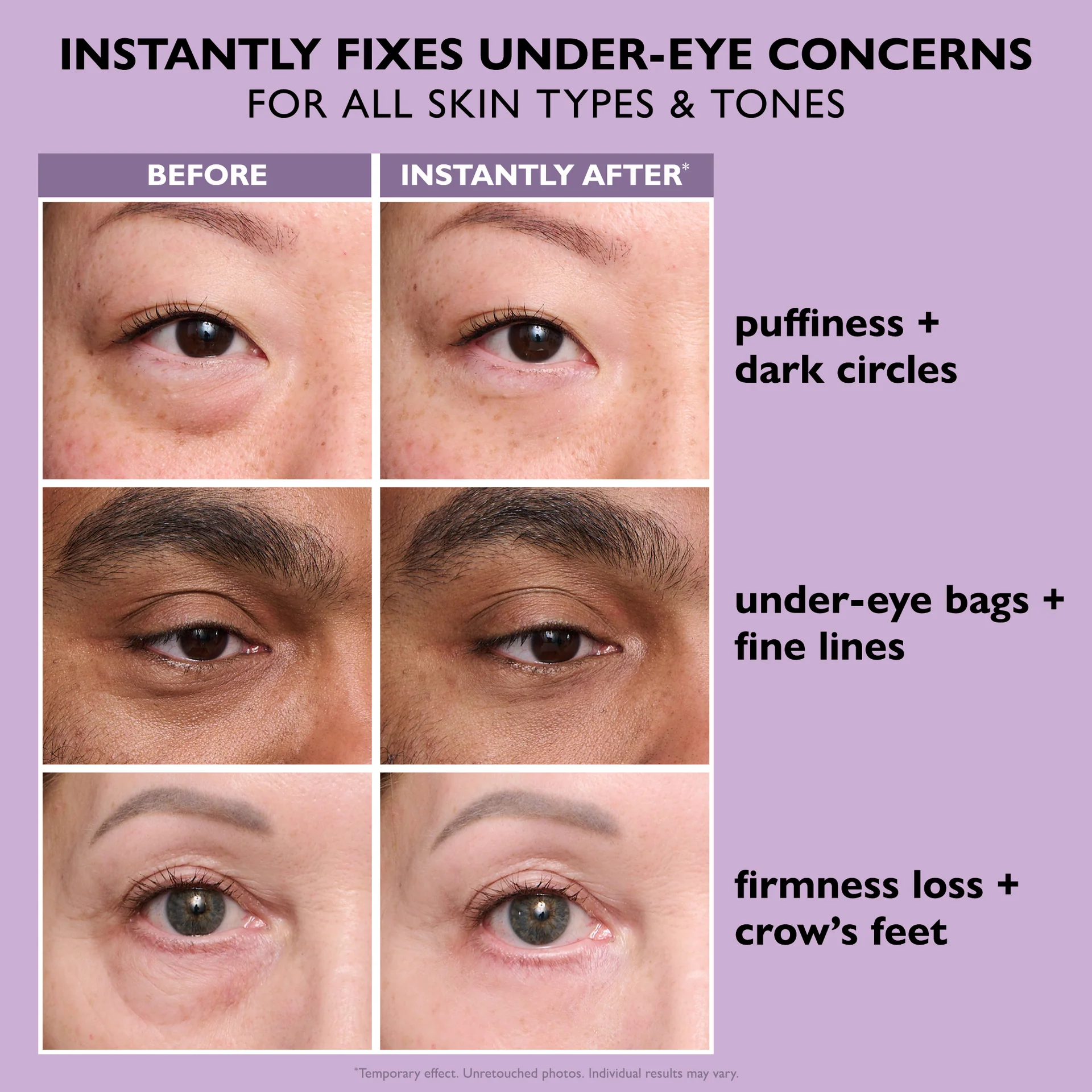 Ava&Rose™ Temporary Eye Tightener