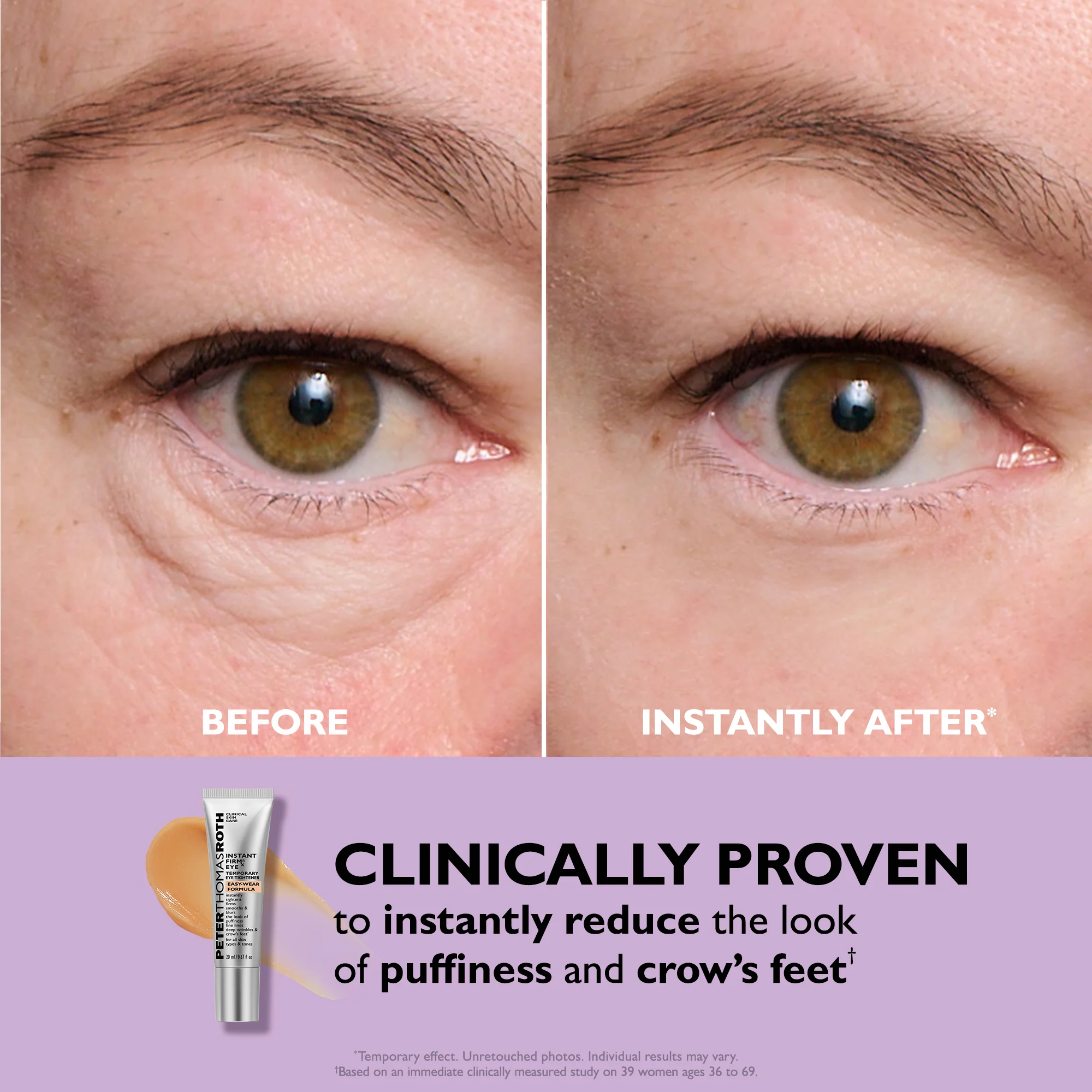 Ava&Rose™ Temporary Eye Tightener
