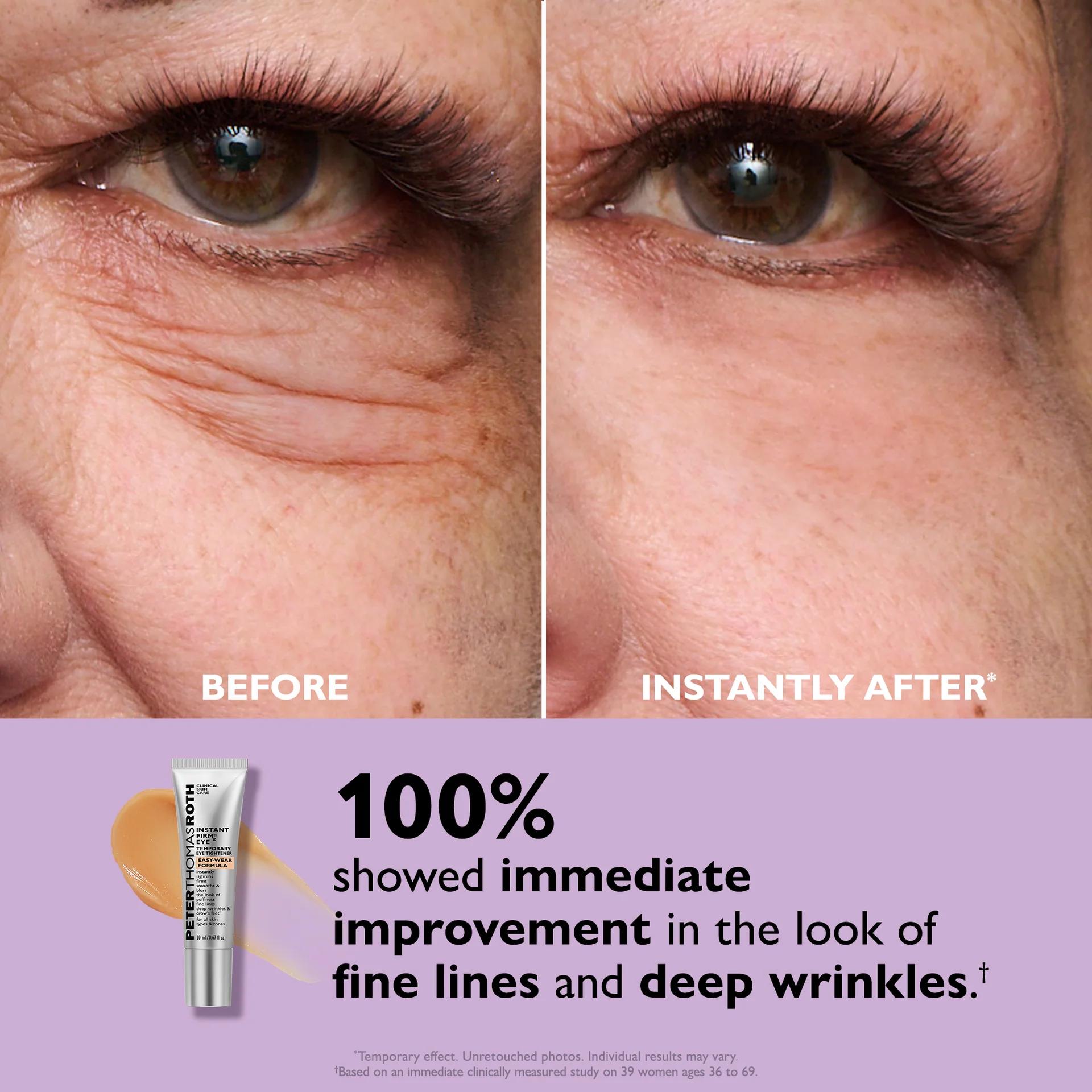 Ava&Rose™ Temporary Eye Tightener