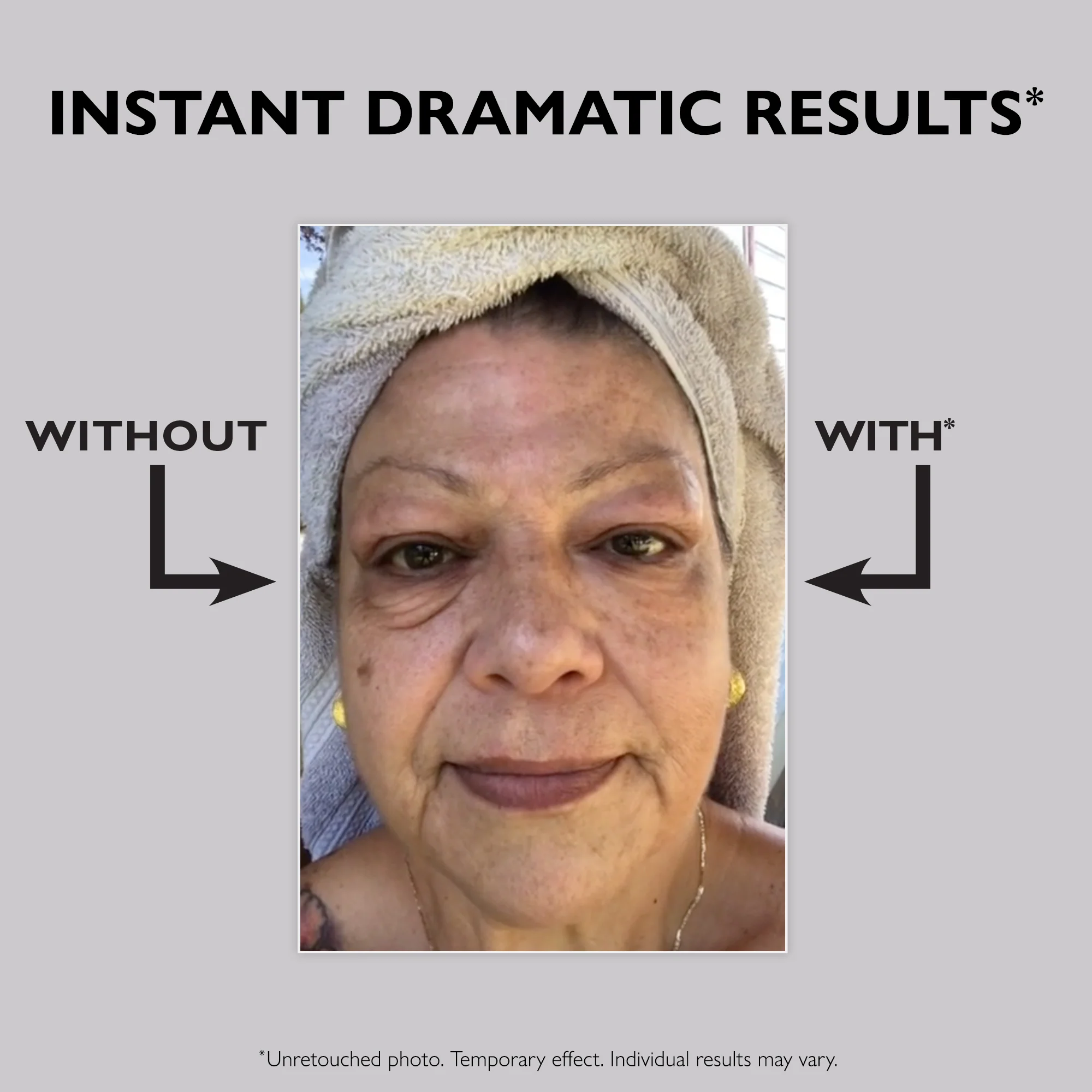 Ava&Rose™ - Temporary Eye Tightener